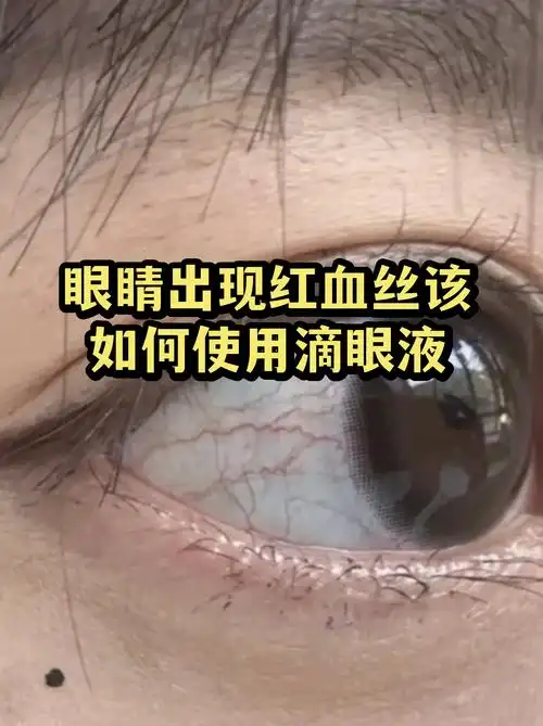 英雄联盟新纪元：上单“眼镜”神器降临，版本答案已锁定？